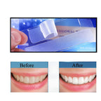 Tiras Blanqueadoras Dentales 3D Bright – Blanqueamiento Profesional Desde Casa